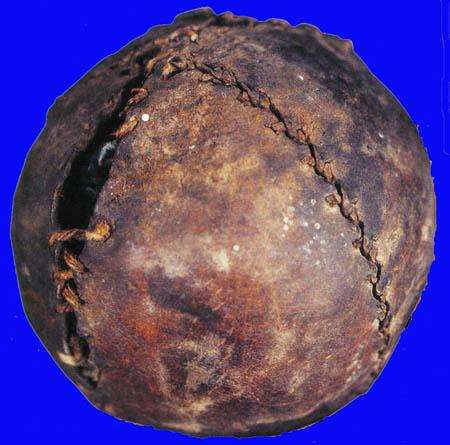 19th Century Lemon Peel Ball 10